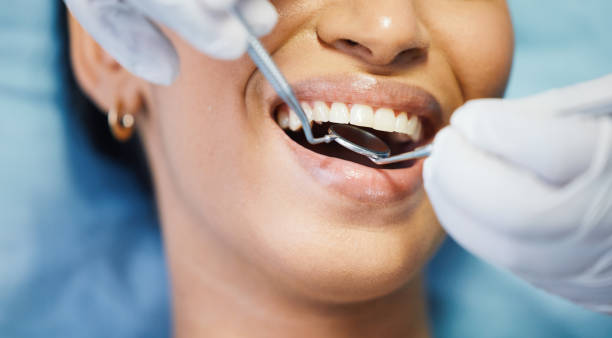Best Knocked-Out Tooth (Avulsed Tooth) Treatment in Biglerville, PA